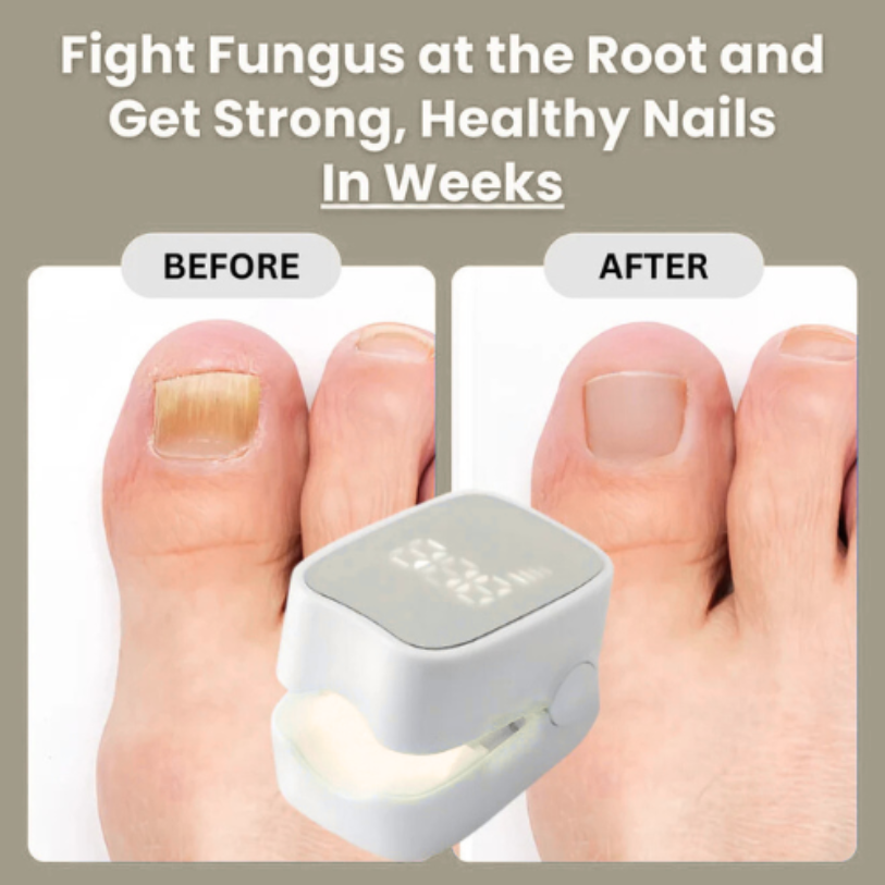 Veraela™ - Nail Fungus Laser Device
