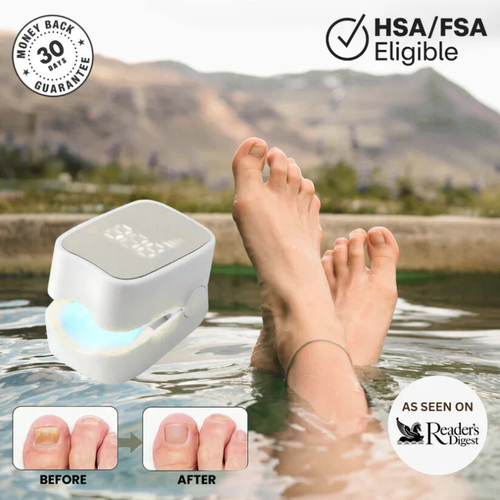 Veraela™ - Nail Fungus Laser Device